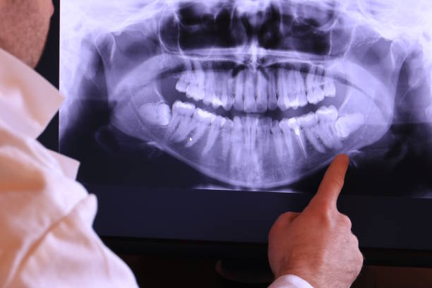 Best Emergency Dentist for Knocked-Out Tooth in Taunton, MA