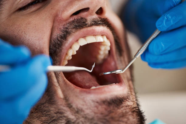 Best Broken or Cracked Tooth Emergency Dentist in Taunton, MA